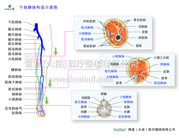 深靜脈血栓形成的預(yù)防與護(hù)理