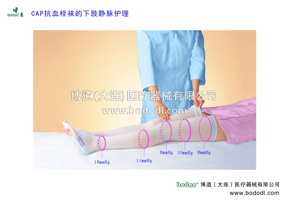 深靜脈血栓形成的預(yù)防與護(hù)理