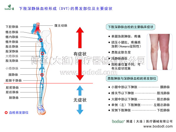 深靜脈血栓形成的預(yù)防與護(hù)理