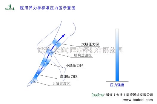 深靜脈血栓形成的預(yù)防與護(hù)理
