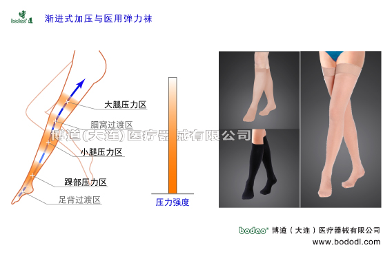 靜脈曲張的預(yù)防與治療