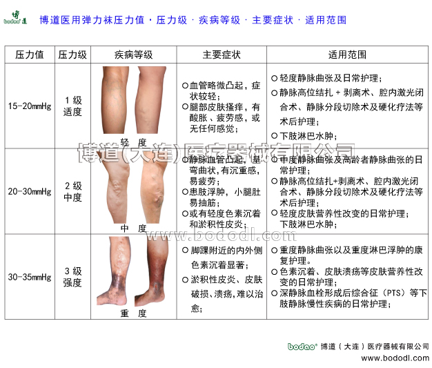 靜脈曲張的預(yù)防與治療
