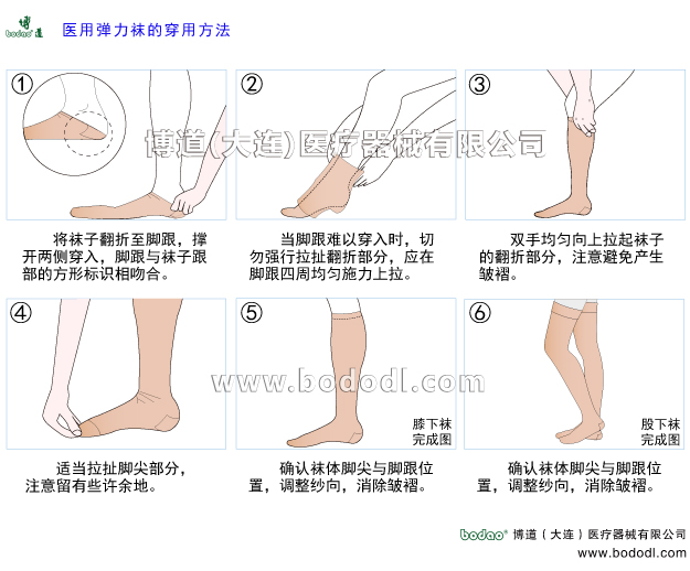 靜脈曲張的預(yù)防與治療