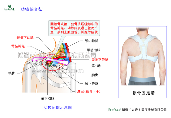 鎖骨的常見傷病與健康防護(hù)