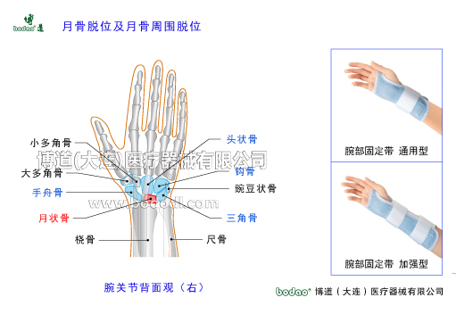 腕關節(jié)的常見疾病與健康防護