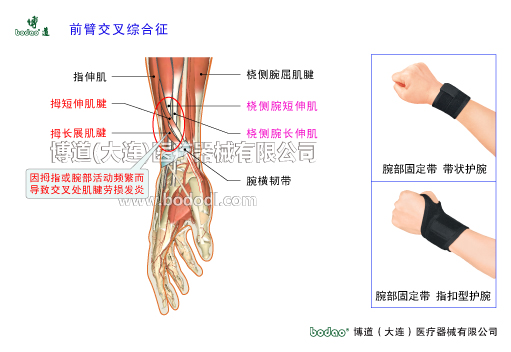 腕關節(jié)的常見疾病與健康防護