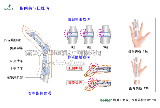 手關(guān)節(jié)常見傷病與健康防護(hù)