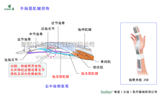 手關(guān)節(jié)常見傷病與健康防護(hù)