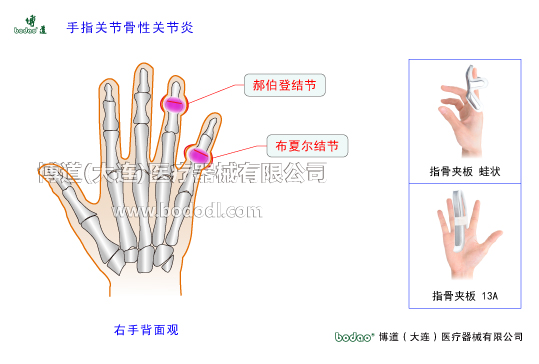 手關(guān)節(jié)常見傷病與健康防護(hù)