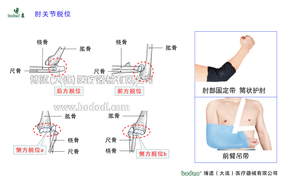 肘關(guān)節(jié)構(gòu)造及其常見(jiàn)傷病
