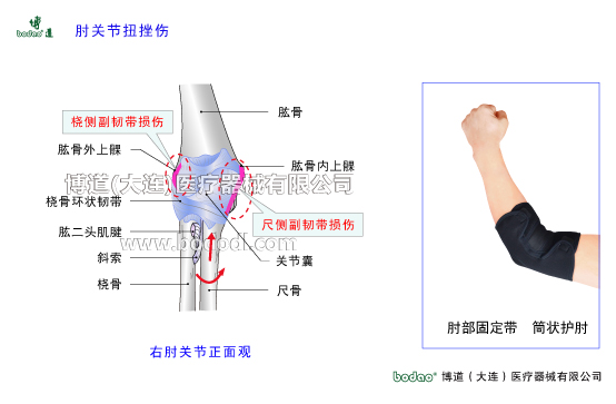 肘關(guān)節(jié)構(gòu)造及其常見(jiàn)傷病