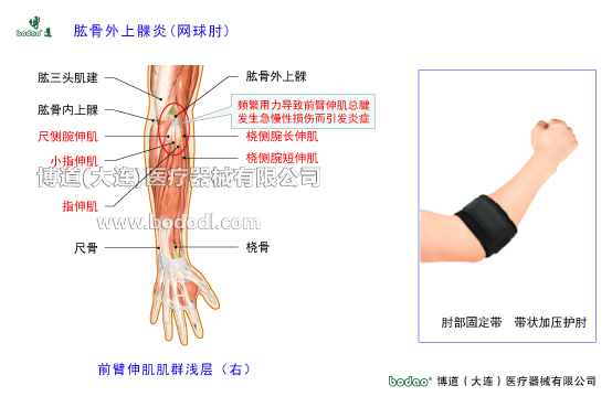肘關(guān)節(jié)構(gòu)造及其常見(jiàn)傷病