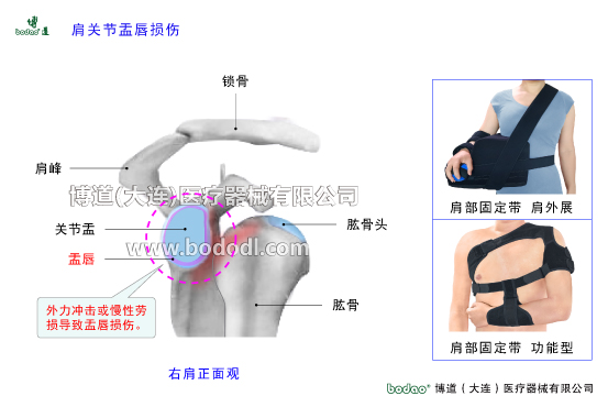 肩關節(jié)的常見疾病與健康防護