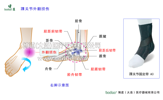 踝關節(jié)的構造與常見傷病