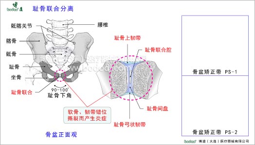骨盆疾病與健康護(hù)理