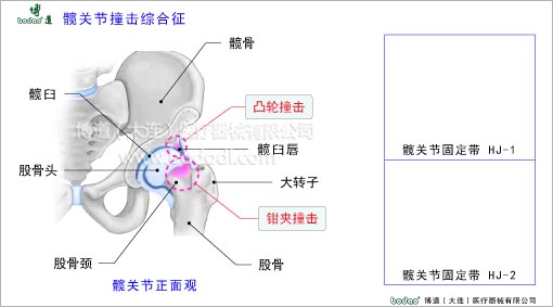 髖關(guān)節(jié)疾病與健康護理