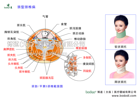 頸型頸椎病的發(fā)病原因與主要癥狀落枕頸椎病的預(yù)防與治療頸椎肌筋膜炎頸椎截面圖頸椎綜合癥頸椎勞損保暖日本頸托高度可調(diào)節(jié)式頸椎矯正固定康復(fù)支具頸部肌肉氣管食管頸淺筋膜頸總動(dòng)脈椎動(dòng)靜脈頸前筋膜頸多裂肌橫突間肌頸多裂肌頸回旋肌頸筋膜淺層頸半棘肌頭夾肌頭半棘肌斜方肌頭最長(zhǎng)肌頸夾肌肩胛提肌斜角肌胸鎖乳突肌頸長(zhǎng)肌頸椎小關(guān)節(jié)不穩(wěn)頸椎骨質(zhì)增生頸椎退行性病變頸肩肌筋膜勞損