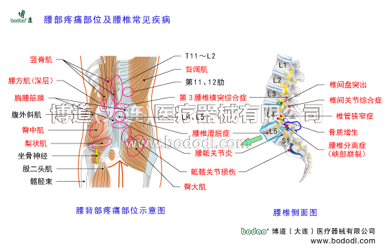 腰椎部常見疾病腰背部疼痛部位腰椎部主要病癥腰椎解剖構(gòu)造腰大肌腰方肌豎脊肌臀大肌臀中肌梨狀肌腹外斜肌背闊肌腰背部主要肌肉第三腰椎橫突綜合征背闊肌胸腰筋膜閃腰扭腰椎固定帶腰部固定帶醫(yī)用護(hù)腰肌勞損腰椎骨質(zhì)增生腰背肌筋膜炎腰椎間盤突出胸腰椎壓縮性骨折腰椎椎管狹窄腰椎小關(guān)節(jié)紊亂腰椎滑脫分離癥腰椎峽部裂腰骶關(guān)節(jié)勞損骶髂關(guān)節(jié)炎腰椎結(jié)核馬尾神經(jīng)綜合癥梨狀肌綜合征腰椎固定支具腰疼帶腰椎矯正固定牽引器腰椎病的預(yù)防與治療