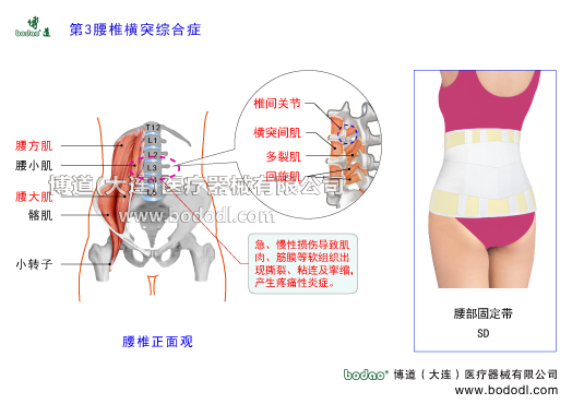 第三腰椎橫突綜合癥及主要癥狀L3橫突綜合征的預(yù)防與治療博道醫(yī)用護(hù)腰部固定帶第3腰椎位于腰椎的中心樞紐第3腰椎的特點是橫突最長附近有血管神經(jīng)束經(jīng)過是腰方肌腰大肌豎脊肌橫突棘肌橫突間肌骶棘肌腰小肌髂肌椎間關(guān)節(jié)多裂肌回旋肌橫突棘肌腰背筋膜的起點或止點，第3腰椎橫突受外力牽拉附著肌肉筋膜撕裂出血瘢痕粘連筋膜增厚攣縮致使血管神經(jīng)束受摩擦刺激和壓迫而出現(xiàn)腰臀部局部性疼痛卡壓綜合癥腰椎壓縮性骨折腰肌筋膜勞損慢性腰