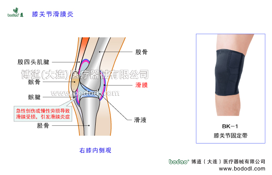 膝關(guān)節(jié)滑膜炎膝關(guān)節(jié)囊損傷博道加壓護膝醫(yī)用保暖矯形固定護膝，膝關(guān)節(jié)滑膜炎的主要癥狀與治療博道膝關(guān)節(jié)固定帶BK-1醫(yī)用護膝哪個好？膝關(guān)節(jié)常見疾病的治療與護理，戶外運動護膝排行榜，股四頭肌腱髕骨臏腱髕韌帶滑液脛骨滑膜膝關(guān)節(jié)囊，右膝側(cè)面觀，膝關(guān)節(jié)軟組織損傷矯正固定支具，膝關(guān)節(jié)骨折專業(yè)固定康復(fù)矯形支具，膝關(guān)節(jié)面膝關(guān)節(jié)腔，膝關(guān)節(jié)滑膜結(jié)締組織，滑膜的功能與作用，膝關(guān)節(jié)急性創(chuàng)傷或慢性勞損，膝關(guān)節(jié)腔內(nèi)積血積液引發(fā)非感