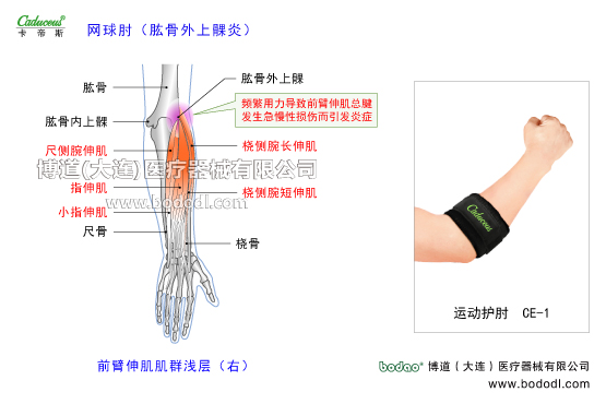 肘關(guān)節(jié)的運(yùn)動(dòng)損傷與防護(hù)