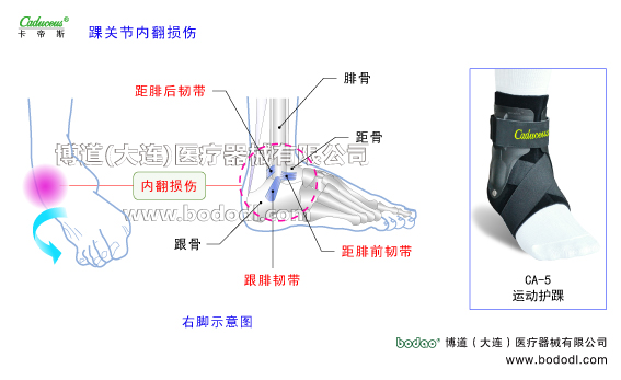 踝關(guān)節(jié)的運(yùn)動(dòng)損傷與防護(hù)