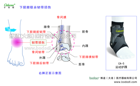 踝關(guān)節(jié)的運(yùn)動(dòng)損傷與防護(hù)