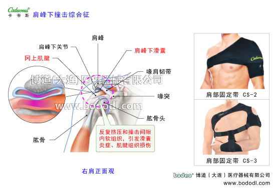 肩關節(jié)的運動損傷與防護