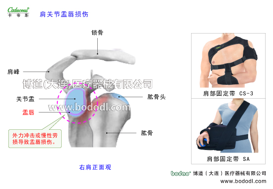 肩關節(jié)的運動損傷與防護