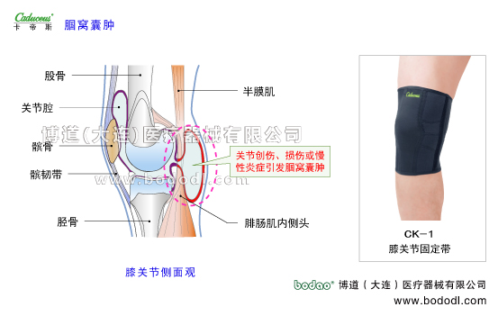 膝關(guān)節(jié)的運(yùn)動(dòng)損傷與防護(hù)