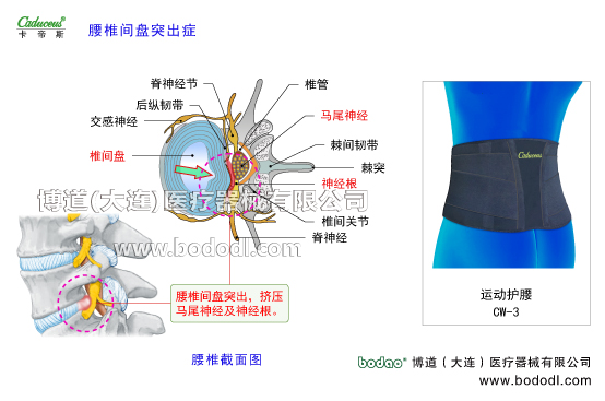 腰椎部的運(yùn)動(dòng)損傷與防護(hù)