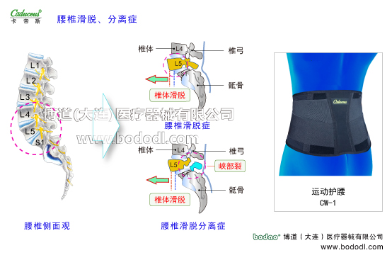 腰椎部的運(yùn)動(dòng)損傷與防護(hù)