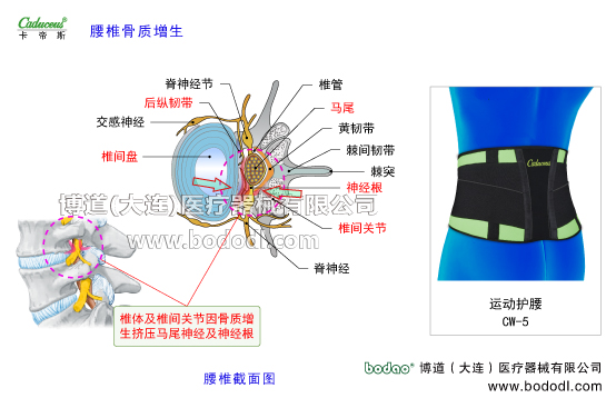 腰椎部的運(yùn)動(dòng)損傷與防護(hù)