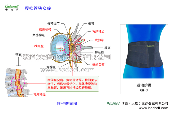 腰椎部的運(yùn)動(dòng)損傷與防護(hù)