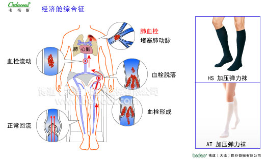 肌肉痙攣與加壓防護