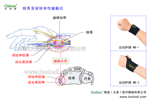 腕關(guān)節(jié)的運(yùn)動(dòng)損傷與防護(hù)