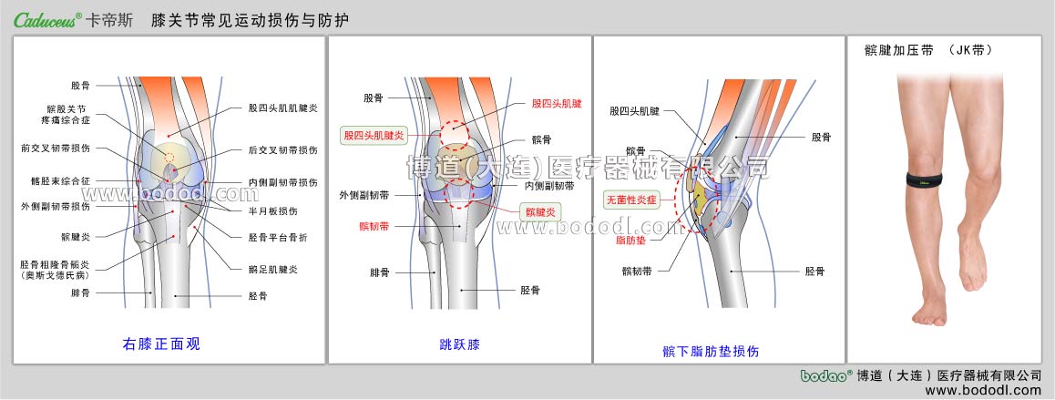 膝の主なスポーツ損傷