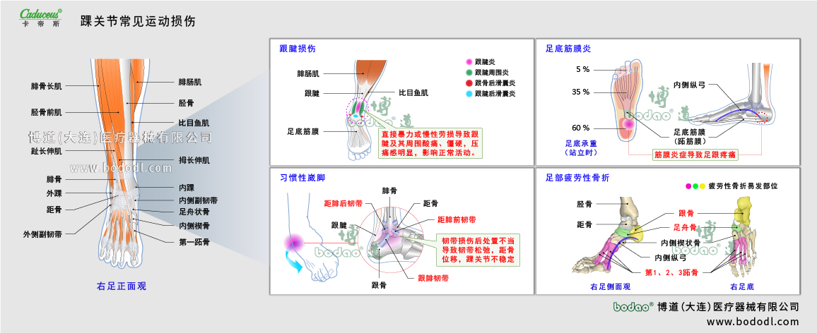 踝關節(jié)運動損傷的類型與癥狀