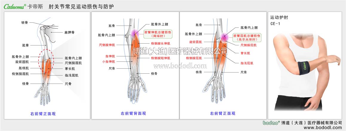 肘の主なスポーツ損傷