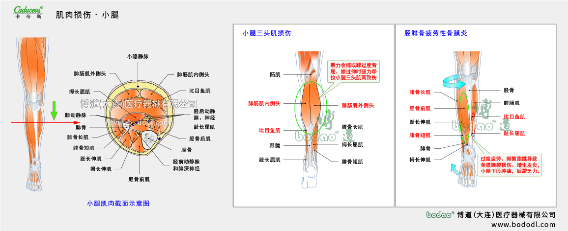 肌肉損傷的易發(fā)部位