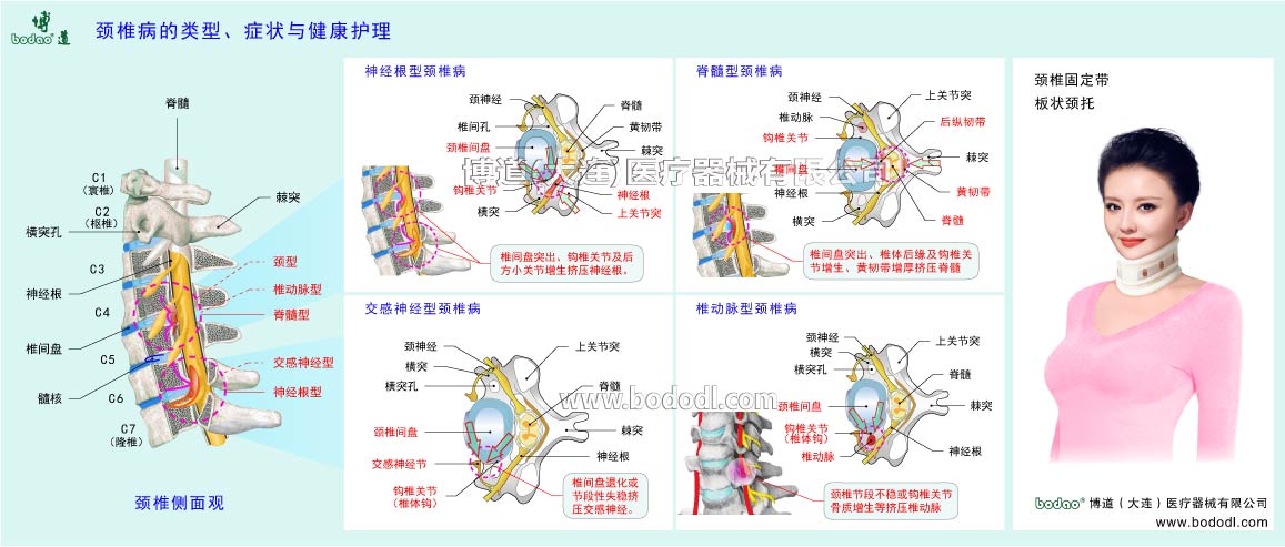 頚椎の主な疾患