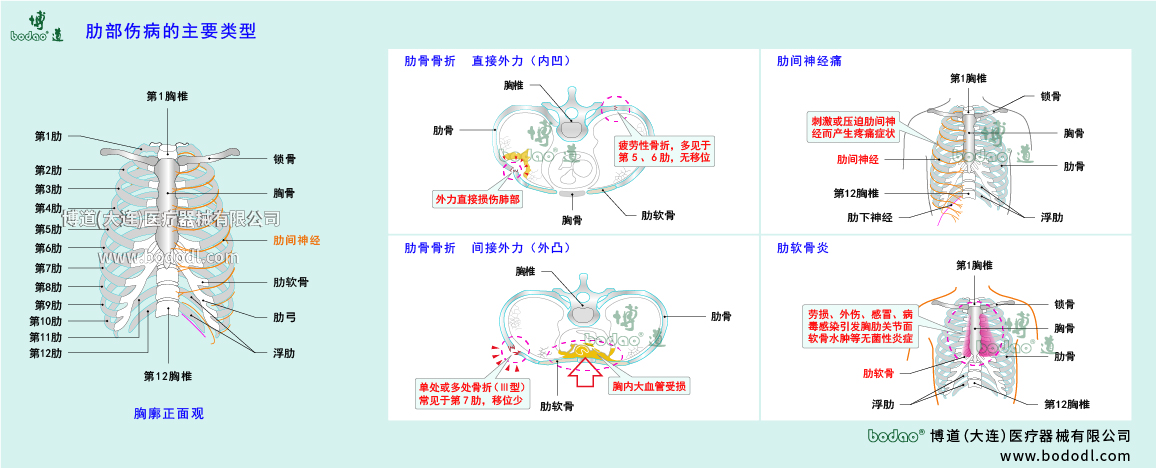 肋部傷病的類(lèi)型與癥狀