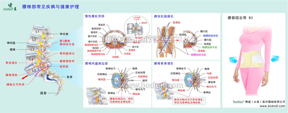 腰部の主な疾患