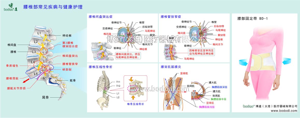 腰部の主な疾患