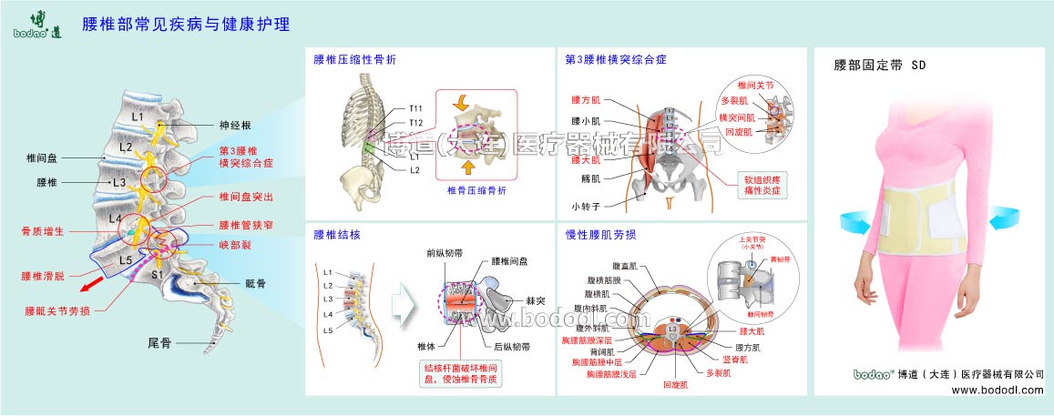 腰部の主な疾患