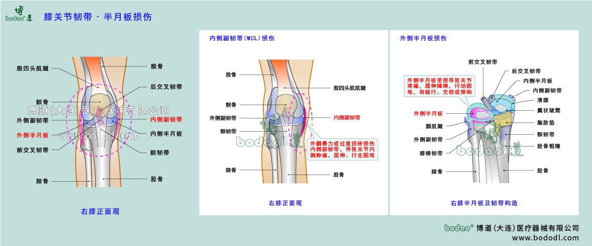 膝關(guān)節(jié)疾病的類型與癥狀