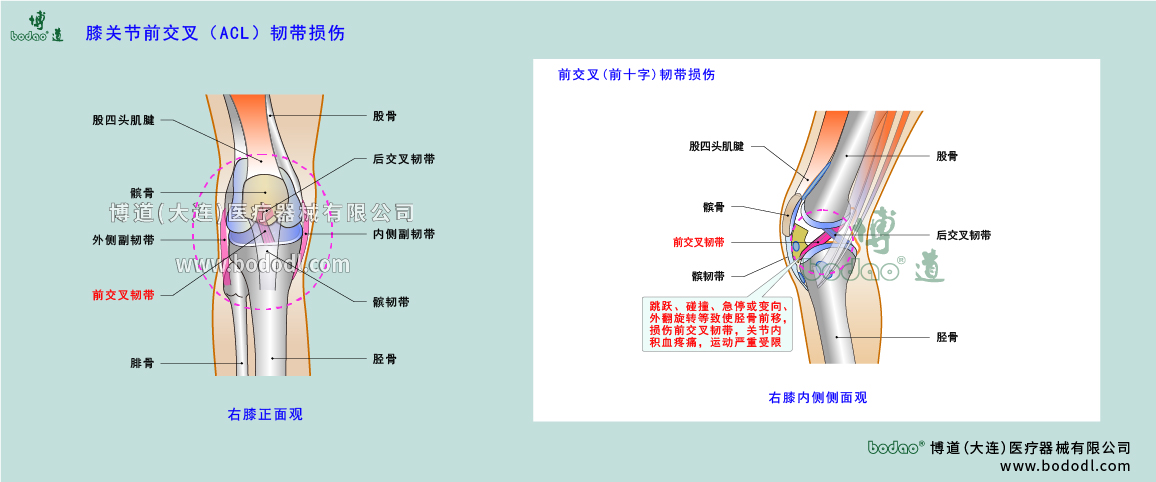 膝關(guān)節(jié)疾病的類型與癥狀