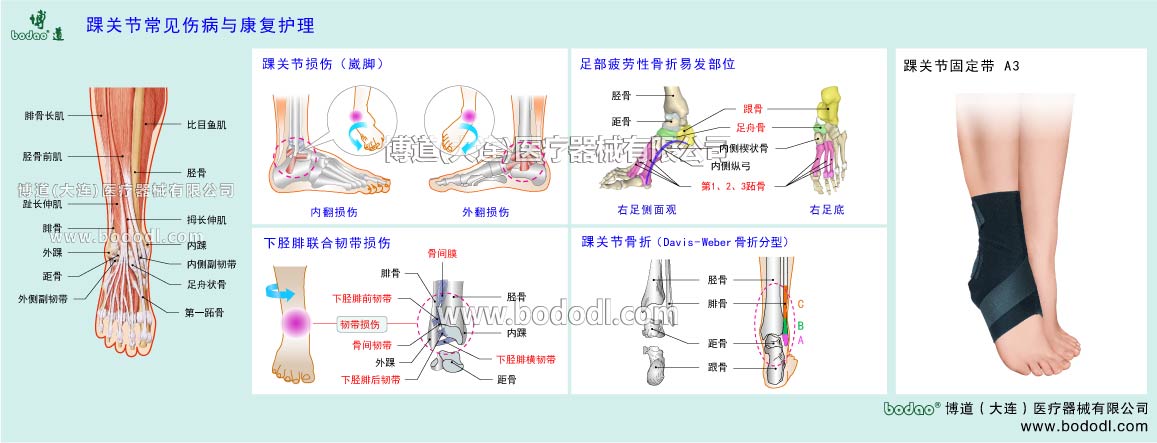 足首の主な疾患