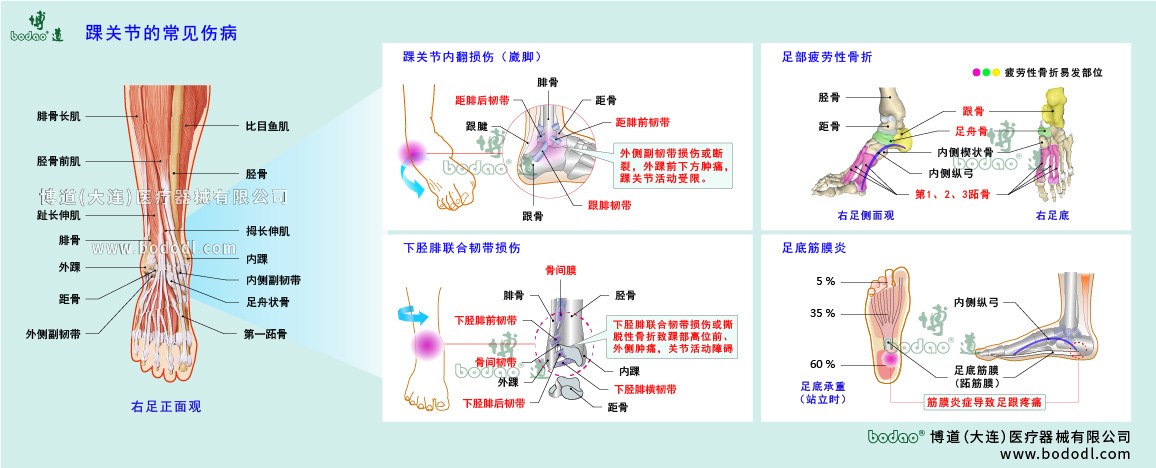 踝關節(jié)傷病的類型與癥狀