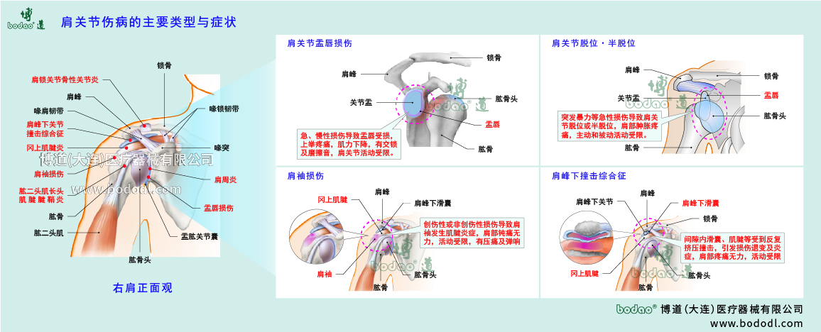 肩關(guān)節(jié)傷病的類(lèi)型與癥狀